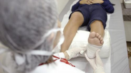 Diabetes requer atenção especial com a pele